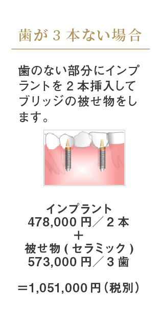 歯が3本ない場合