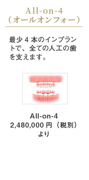 オールオンフォー