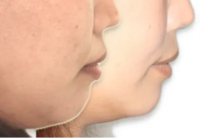 口元の美しさや顔全体のバランスにも配慮