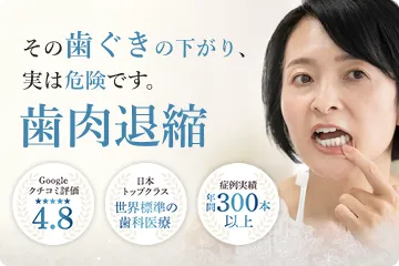 歯肉退縮
