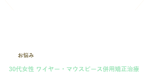 インビザライン矯正動画
