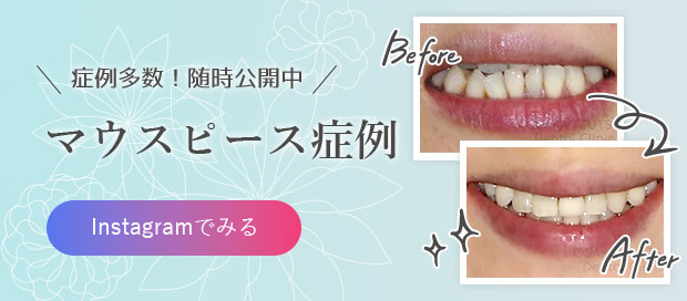 マウスピース症例
