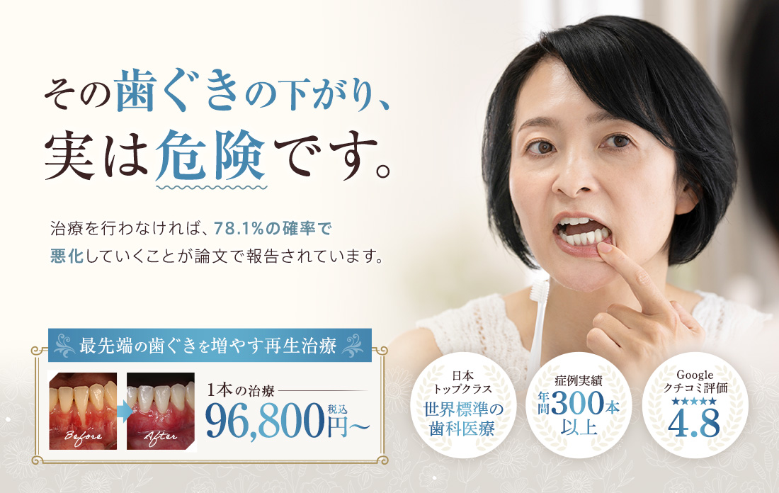 その歯ぐきの下がり、実は危険です。