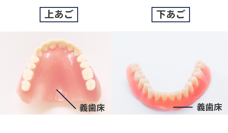 総入れ歯