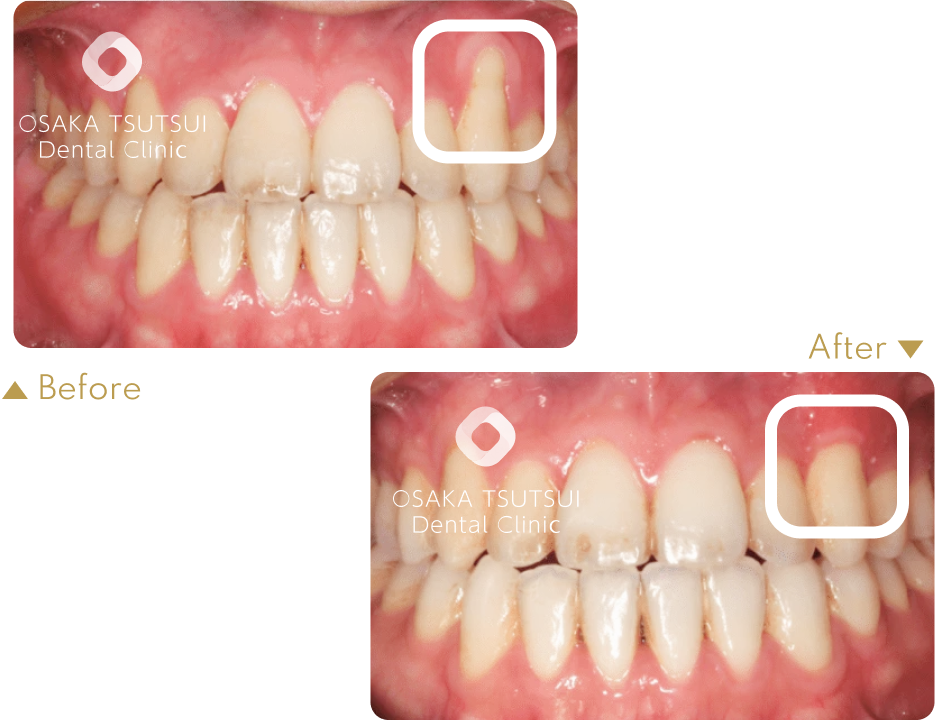 治療前後の比較
