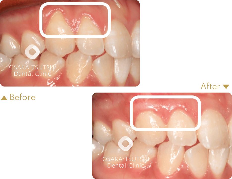 治療前後の比較