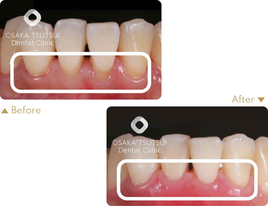 治療前後の比較