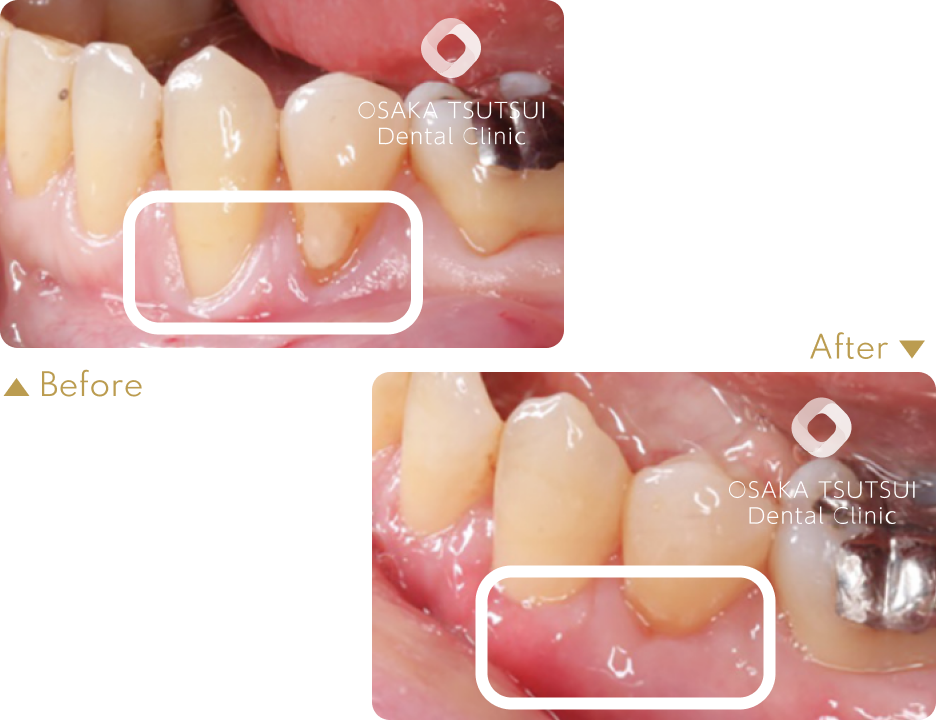 治療前後の比較