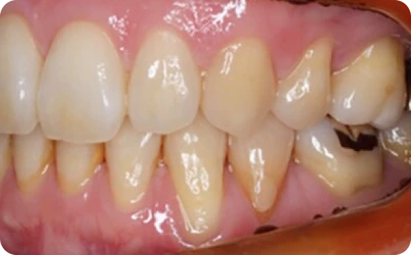 治療前後の比較