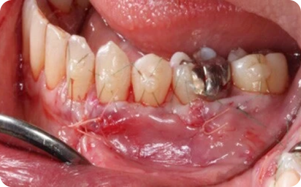 治療前後の比較