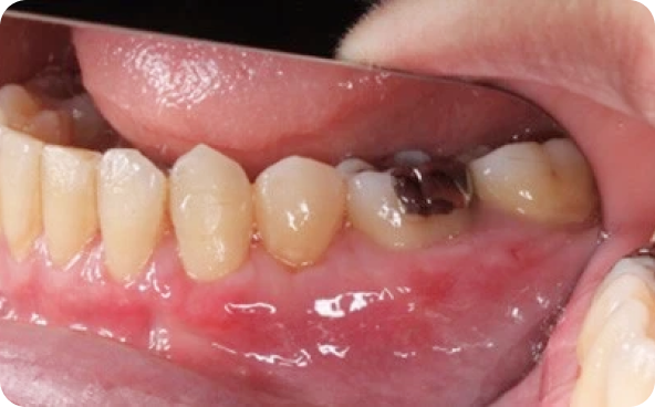 治療前後の比較