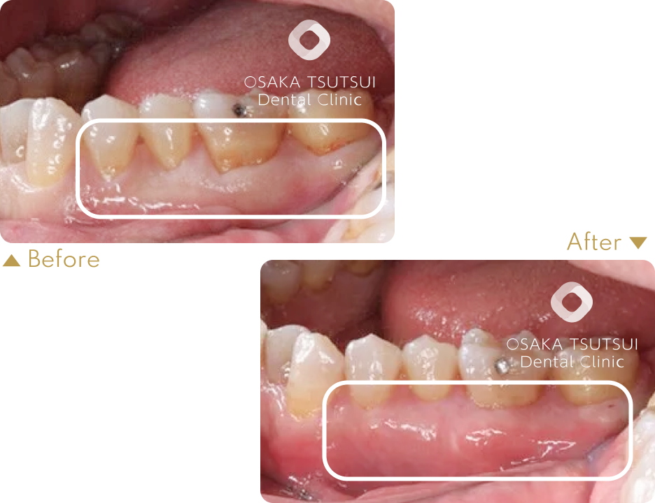 治療前後の比較