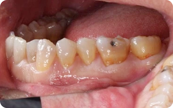 治療前後の比較