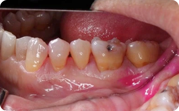 治療前後の比較