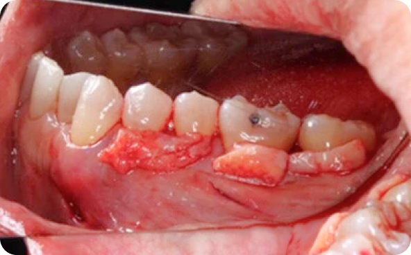 治療前後の比較