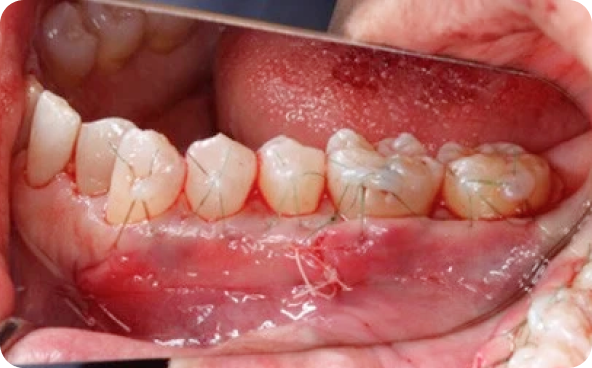 治療前後の比較