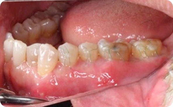 治療前後の比較