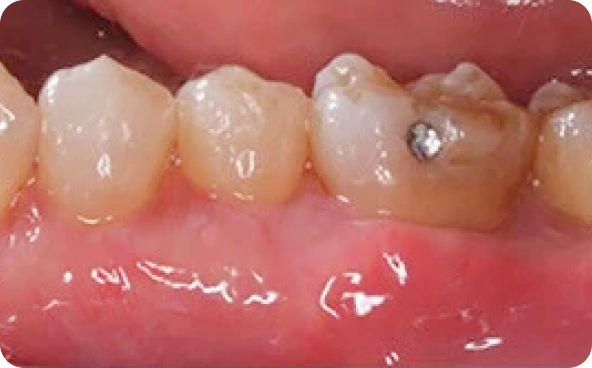 治療前後の比較