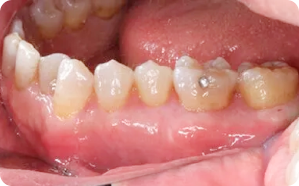 治療前後の比較