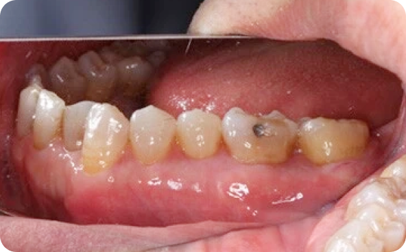 治療前後の比較