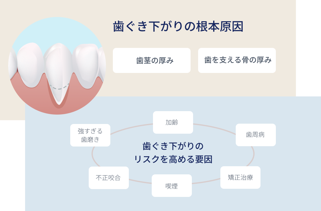 歯ぐき下がりの根本原因