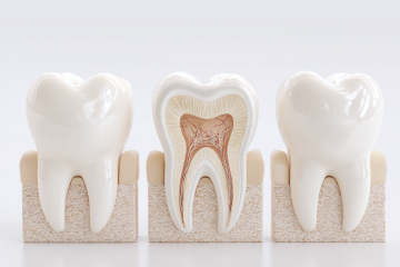 非う蝕性歯頸部疾患