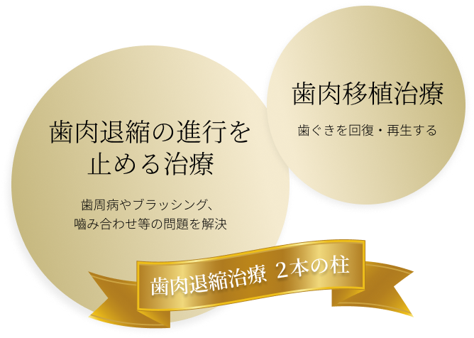 歯肉退縮の説明画像