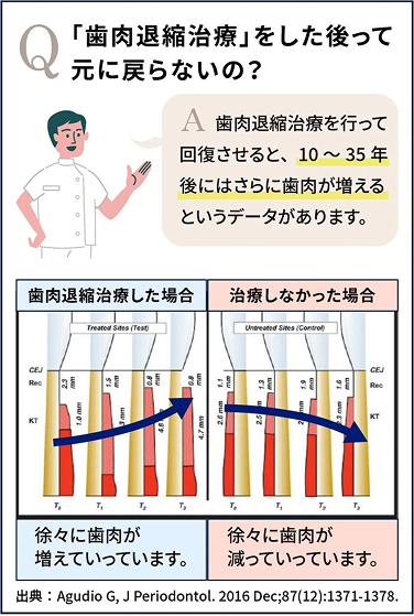 歯肉移植による長期的な治療効果の解説図